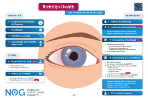 Infographic herziene richtlijn Uveïtis gepubliceerd