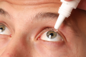 NOG bezig met NSAID-tekort